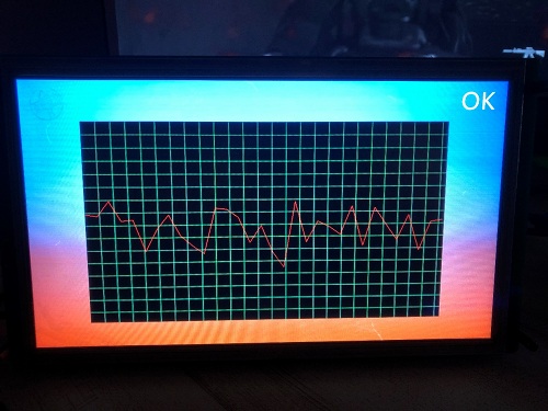 Medical-Ventilator-STONE HMI-ESP32 (22).jpg